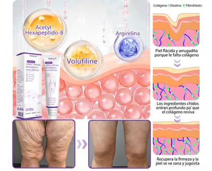 𝑹𝒆𝒄𝒐𝒎𝒆𝒏𝒅𝒂𝒅𝒐 𝙥𝙤𝙧 𝗱𝗲𝗿𝐦𝐚𝐭ó𝐥𝐨𝐠𝐨𝐬👩‍⚕️ | 🦩𝙑𝙞𝙩𝙖𝒍𝒊𝒔𝒚𝐬®𝘊𝘳𝘦𝘮𝘢 𝘔𝘢𝘴𝘢𝘫𝘦𝘢𝘥𝘰𝘳𝘢 𝘊𝘰𝘳𝘱𝘰𝘳𝘢𝘭 𝘦𝘯 𝘙𝘰𝘭𝘭-𝘖𝘯 𝘤𝘰𝘯 𝘗𝘋𝘙𝘕 𝘺 𝘔𝘶𝘭𝘵𝘪𝘱é𝘱𝘵𝘪𝘥𝘰𝘴 - 𝘈𝘯𝘵𝘪𝘦𝘯𝘷𝘦𝘫𝘦𝘤𝘪𝘮𝘪𝘦𝘯𝘵𝘰, 𝘙𝘦𝘢𝘧𝘪𝘳𝘮𝘢𝘯𝘵𝘦 𝘺 𝘌𝘧𝘦𝘤𝘵𝘰 𝘓𝘪𝘧𝘵𝘪𝘯𝘨, 𝑈𝑛𝑖𝑓𝑖𝑐𝑎 𝑒𝑙 𝑇𝑜𝑛𝑜, 𝑇𝑟𝑎𝑡𝑎𝑚𝑖𝑒𝑛𝑡𝑜 𝑝𝑎𝑟𝑎 𝐴𝑐𝑛é 𝑦 𝑀𝑎𝑛𝑐ℎ𝑎𝑠 𝑂𝑠𝑐𝑢𝑟𝑎𝑠, 𝐸𝑙𝑖𝑚𝑖𝑛𝑎𝑐𝑖ó𝑛 𝑑𝑒 𝑉𝑒𝑟𝑟𝑢𝑔𝑎𝑠 𝑦 𝐿𝑢𝑛𝑎𝑟𝑒𝑠.🐣