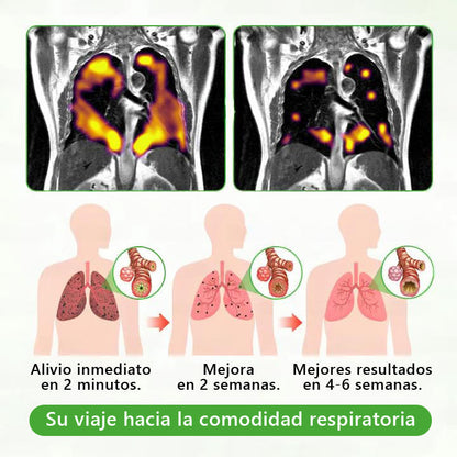 Oferta por tiempo limitado: 30% de descuento en el segundo artículo 🔥𝐌𝐮𝐫𝑤𝗈𝒏® Difusor Botánico de Mullein para Limpieza de Pulmones