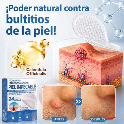 👩‍⚕️💯 𝑻𝒊𝒆𝒏𝙙𝙖 𝑶𝒇𝒊𝗰𝗶𝗮𝗹 | 𝑴𝑼𝙍𝙒𝓞𝓝® 🦩 𝐏𝐚𝐫𝐜𝐡𝐞𝐬 𝐝𝐞 𝐌𝐢𝐜𝐫𝐨𝐚𝐠𝐮𝐣𝐚𝐬 𝐩𝐚𝐫𝐚 𝐏𝐢𝐞𝐥 𝐏𝐞𝐫𝐟𝐞𝐜𝐭𝐚 𝐲 𝐄𝐥𝐢𝐦𝐢𝐧𝐚𝐜𝐢ó𝐧 𝐝𝐞 𝐕𝐞𝐫𝐫𝐮𝐠𝐚𝐬  (𝙋𝙖𝙧𝙖 𝙖𝙘𝙧𝙤𝙘𝙤𝙧𝙙𝙤𝙣𝙚𝙨, 𝙞𝙢𝙥𝙚𝙧𝙛𝙚𝙘𝙘𝙞𝙤𝙣𝙚𝙨, 𝙡𝙪𝙣𝙖𝙧𝙚𝙨, 𝙢𝙖𝙣𝙘𝙝𝙖𝙨 𝙙𝙚 𝙡𝙖 𝙚𝙙𝙖𝙙 𝙮 𝙥𝙞𝙜𝙢𝙚𝙣𝙩𝙖𝙘𝙞ó𝙣)🐧