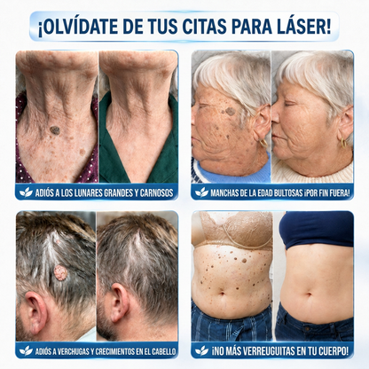 👩‍⚕️💯 𝑻𝒊𝒆𝒏𝙙𝙖 𝑶𝒇𝒊𝗰𝗶𝗮𝗹 | 𝑴𝑼𝙍𝙒𝓞𝓝® 🦩 𝐏𝐚𝐫𝐜𝐡𝐞𝐬 𝐝𝐞 𝐌𝐢𝐜𝐫𝐨𝐚𝐠𝐮𝐣𝐚𝐬 𝐩𝐚𝐫𝐚 𝐏𝐢𝐞𝐥 𝐏𝐞𝐫𝐟𝐞𝐜𝐭𝐚 𝐲 𝐄𝐥𝐢𝐦𝐢𝐧𝐚𝐜𝐢ó𝐧 𝐝𝐞 𝐕𝐞𝐫𝐫𝐮𝐠𝐚𝐬  (𝙋𝙖𝙧𝙖 𝙖𝙘𝙧𝙤𝙘𝙤𝙧𝙙𝙤𝙣𝙚𝙨, 𝙞𝙢𝙥𝙚𝙧𝙛𝙚𝙘𝙘𝙞𝙤𝙣𝙚𝙨, 𝙡𝙪𝙣𝙖𝙧𝙚𝙨, 𝙢𝙖𝙣𝙘𝙝𝙖𝙨 𝙙𝙚 𝙡𝙖 𝙚𝙙𝙖𝙙 𝙮 𝙥𝙞𝙜𝙢𝙚𝙣𝙩𝙖𝙘𝙞ó𝙣)🐧