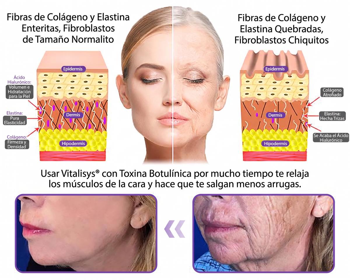 𝑹𝒆𝒄𝒐𝒎𝒆𝒏𝒅𝒂𝒅𝒐 𝙥𝙤𝙧 𝗱𝗲𝗿𝐦𝐚𝐭ó𝐥𝐨𝐠𝐨𝐬👩‍⚕️ | 🦩𝙑𝙞𝙩𝙖𝒍𝒊𝒔𝒚𝐬®𝘊𝘳𝘦𝘮𝘢 𝘔𝘢𝘴𝘢𝘫𝘦𝘢𝘥𝘰𝘳𝘢 𝘊𝘰𝘳𝘱𝘰𝘳𝘢𝘭 𝘦𝘯 𝘙𝘰𝘭𝘭-𝘖𝘯 𝘤𝘰𝘯 𝘗𝘋𝘙𝘕 𝘺 𝘔𝘶𝘭𝘵𝘪𝘱é𝘱𝘵𝘪𝘥𝘰𝘴 - 𝘈𝘯𝘵𝘪𝘦𝘯𝘷𝘦𝘫𝘦𝘤𝘪𝘮𝘪𝘦𝘯𝘵𝘰, 𝘙𝘦𝘢𝘧𝘪𝘳𝘮𝘢𝘯𝘵𝘦 𝘺 𝘌𝘧𝘦𝘤𝘵𝘰 𝘓𝘪𝘧𝘵𝘪𝘯𝘨, 𝑈𝑛𝑖𝑓𝑖𝑐𝑎 𝑒𝑙 𝑇𝑜𝑛𝑜, 𝑇𝑟𝑎𝑡𝑎𝑚𝑖𝑒𝑛𝑡𝑜 𝑝𝑎𝑟𝑎 𝐴𝑐𝑛é 𝑦 𝑀𝑎𝑛𝑐ℎ𝑎𝑠 𝑂𝑠𝑐𝑢𝑟𝑎𝑠, 𝐸𝑙𝑖𝑚𝑖𝑛𝑎𝑐𝑖ó𝑛 𝑑𝑒 𝑉𝑒𝑟𝑟𝑢𝑔𝑎𝑠 𝑦 𝐿𝑢𝑛𝑎𝑟𝑒𝑠.🐣