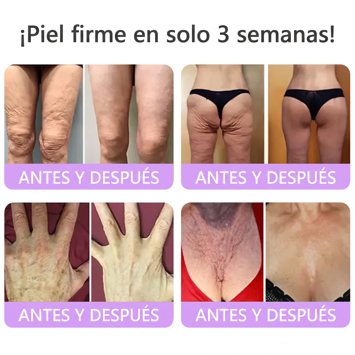 𝑹𝒆𝒄𝒐𝒎𝒆𝒏𝒅𝒂𝒅𝒐 𝙥𝙤𝙧 𝗱𝗲𝗿𝐦𝐚𝐭ó𝐥𝐨𝐠𝐨𝐬👩‍⚕️ | 🦩𝙑𝙞𝙩𝙖𝒍𝒊𝒔𝒚𝐬®𝘊𝘳𝘦𝘮𝘢 𝘔𝘢𝘴𝘢𝘫𝘦𝘢𝘥𝘰𝘳𝘢 𝘊𝘰𝘳𝘱𝘰𝘳𝘢𝘭 𝘦𝘯 𝘙𝘰𝘭𝘭-𝘖𝘯 𝘤𝘰𝘯 𝘗𝘋𝘙𝘕 𝘺 𝘔𝘶𝘭𝘵𝘪𝘱é𝘱𝘵𝘪𝘥𝘰𝘴 - 𝘈𝘯𝘵𝘪𝘦𝘯𝘷𝘦𝘫𝘦𝘤𝘪𝘮𝘪𝘦𝘯𝘵𝘰, 𝘙𝘦𝘢𝘧𝘪𝘳𝘮𝘢𝘯𝘵𝘦 𝘺 𝘌𝘧𝘦𝘤𝘵𝘰 𝘓𝘪𝘧𝘵𝘪𝘯𝘨, 𝑈𝑛𝑖𝑓𝑖𝑐𝑎 𝑒𝑙 𝑇𝑜𝑛𝑜, 𝑇𝑟𝑎𝑡𝑎𝑚𝑖𝑒𝑛𝑡𝑜 𝑝𝑎𝑟𝑎 𝐴𝑐𝑛é 𝑦 𝑀𝑎𝑛𝑐ℎ𝑎𝑠 𝑂𝑠𝑐𝑢𝑟𝑎𝑠, 𝐸𝑙𝑖𝑚𝑖𝑛𝑎𝑐𝑖ó𝑛 𝑑𝑒 𝑉𝑒𝑟𝑟𝑢𝑔𝑎𝑠 𝑦 𝐿𝑢𝑛𝑎𝑟𝑒𝑠.🐣