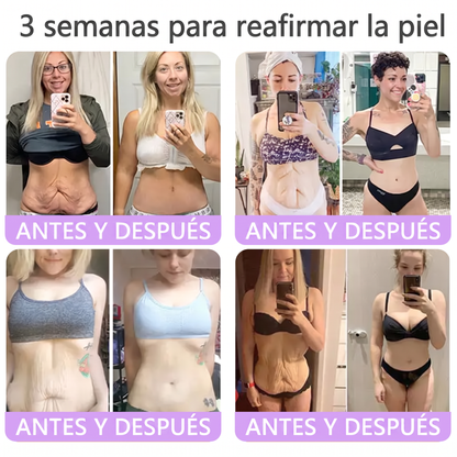 𝑹𝒆𝒄𝒐𝒎𝒆𝒏𝒅𝒂𝒅𝒐 𝙥𝙤𝙧 𝗱𝗲𝗿𝐦𝐚𝐭ó𝐥𝐨𝐠𝐨𝐬👩‍⚕️ | 🦩𝙑𝙞𝙩𝙖𝒍𝒊𝒔𝒚𝐬®𝘊𝘳𝘦𝘮𝘢 𝘔𝘢𝘴𝘢𝘫𝘦𝘢𝘥𝘰𝘳𝘢 𝘊𝘰𝘳𝘱𝘰𝘳𝘢𝘭 𝘦𝘯 𝘙𝘰𝘭𝘭-𝘖𝘯 𝘤𝘰𝘯 𝘗𝘋𝘙𝘕 𝘺 𝘔𝘶𝘭𝘵𝘪𝘱é𝘱𝘵𝘪𝘥𝘰𝘴 - 𝘈𝘯𝘵𝘪𝘦𝘯𝘷𝘦𝘫𝘦𝘤𝘪𝘮𝘪𝘦𝘯𝘵𝘰, 𝘙𝘦𝘢𝘧𝘪𝘳𝘮𝘢𝘯𝘵𝘦 𝘺 𝘌𝘧𝘦𝘤𝘵𝘰 𝘓𝘪𝘧𝘵𝘪𝘯𝘨, 𝑈𝑛𝑖𝑓𝑖𝑐𝑎 𝑒𝑙 𝑇𝑜𝑛𝑜, 𝑇𝑟𝑎𝑡𝑎𝑚𝑖𝑒𝑛𝑡𝑜 𝑝𝑎𝑟𝑎 𝐴𝑐𝑛é 𝑦 𝑀𝑎𝑛𝑐ℎ𝑎𝑠 𝑂𝑠𝑐𝑢𝑟𝑎𝑠, 𝐸𝑙𝑖𝑚𝑖𝑛𝑎𝑐𝑖ó𝑛 𝑑𝑒 𝑉𝑒𝑟𝑟𝑢𝑔𝑎𝑠 𝑦 𝐿𝑢𝑛𝑎𝑟𝑒𝑠.🐣