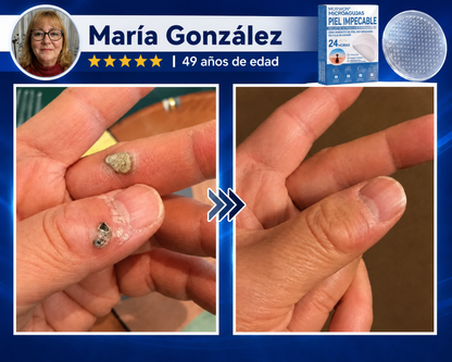 👩‍⚕️💯 𝑻𝒊𝒆𝒏𝙙𝙖 𝑶𝒇𝒊𝗰𝗶𝗮𝗹 | 𝑴𝑼𝙍𝙒𝓞𝓝® 🦩 𝐏𝐚𝐫𝐜𝐡𝐞𝐬 𝐝𝐞 𝐌𝐢𝐜𝐫𝐨𝐚𝐠𝐮𝐣𝐚𝐬 𝐩𝐚𝐫𝐚 𝐏𝐢𝐞𝐥 𝐏𝐞𝐫𝐟𝐞𝐜𝐭𝐚 𝐲 𝐄𝐥𝐢𝐦𝐢𝐧𝐚𝐜𝐢ó𝐧 𝐝𝐞 𝐕𝐞𝐫𝐫𝐮𝐠𝐚𝐬  (𝙋𝙖𝙧𝙖 𝙖𝙘𝙧𝙤𝙘𝙤𝙧𝙙𝙤𝙣𝙚𝙨, 𝙞𝙢𝙥𝙚𝙧𝙛𝙚𝙘𝙘𝙞𝙤𝙣𝙚𝙨, 𝙡𝙪𝙣𝙖𝙧𝙚𝙨, 𝙢𝙖𝙣𝙘𝙝𝙖𝙨 𝙙𝙚 𝙡𝙖 𝙚𝙙𝙖𝙙 𝙮 𝙥𝙞𝙜𝙢𝙚𝙣𝙩𝙖𝙘𝙞ó𝙣)🐧