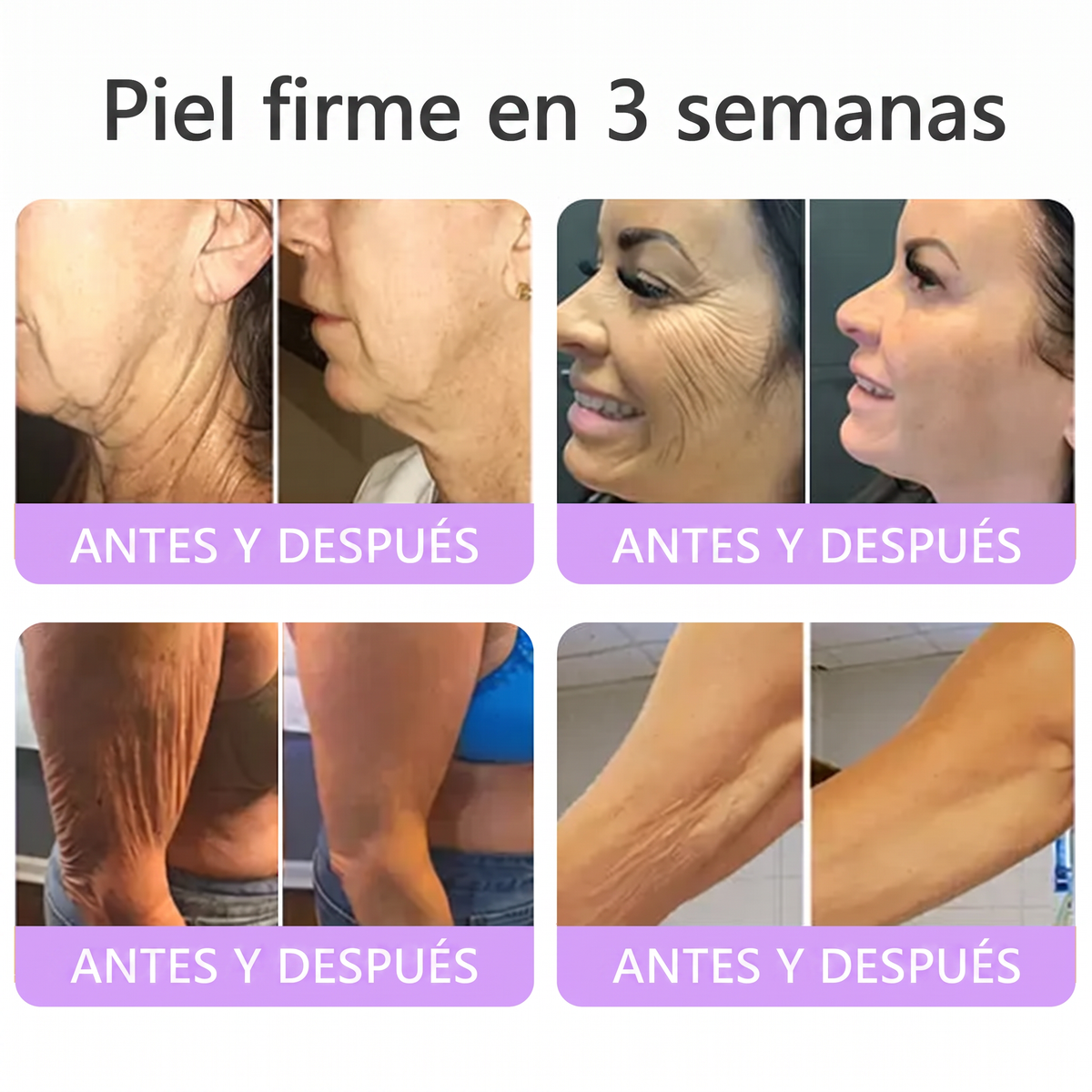 𝑹𝒆𝒄𝒐𝒎𝒆𝒏𝒅𝒂𝒅𝒐 𝙥𝙤𝙧 𝗱𝗲𝗿𝐦𝐚𝐭ó𝐥𝐨𝐠𝐨𝐬👩‍⚕️ | 🦩𝙑𝙞𝙩𝙖𝒍𝒊𝒔𝒚𝐬®𝘊𝘳𝘦𝘮𝘢 𝘔𝘢𝘴𝘢𝘫𝘦𝘢𝘥𝘰𝘳𝘢 𝘊𝘰𝘳𝘱𝘰𝘳𝘢𝘭 𝘦𝘯 𝘙𝘰𝘭𝘭-𝘖𝘯 𝘤𝘰𝘯 𝘗𝘋𝘙𝘕 𝘺 𝘔𝘶𝘭𝘵𝘪𝘱é𝘱𝘵𝘪𝘥𝘰𝘴 - 𝘈𝘯𝘵𝘪𝘦𝘯𝘷𝘦𝘫𝘦𝘤𝘪𝘮𝘪𝘦𝘯𝘵𝘰, 𝘙𝘦𝘢𝘧𝘪𝘳𝘮𝘢𝘯𝘵𝘦 𝘺 𝘌𝘧𝘦𝘤𝘵𝘰 𝘓𝘪𝘧𝘵𝘪𝘯𝘨, 𝑈𝑛𝑖𝑓𝑖𝑐𝑎 𝑒𝑙 𝑇𝑜𝑛𝑜, 𝑇𝑟𝑎𝑡𝑎𝑚𝑖𝑒𝑛𝑡𝑜 𝑝𝑎𝑟𝑎 𝐴𝑐𝑛é 𝑦 𝑀𝑎𝑛𝑐ℎ𝑎𝑠 𝑂𝑠𝑐𝑢𝑟𝑎𝑠, 𝐸𝑙𝑖𝑚𝑖𝑛𝑎𝑐𝑖ó𝑛 𝑑𝑒 𝑉𝑒𝑟𝑟𝑢𝑔𝑎𝑠 𝑦 𝐿𝑢𝑛𝑎𝑟𝑒𝑠.🐣
