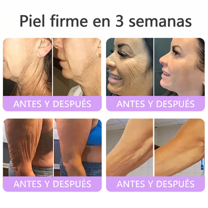 𝑹𝒆𝒄𝒐𝒎𝒆𝒏𝒅𝒂𝒅𝒐 𝙥𝙤𝙧 𝗱𝗲𝗿𝐦𝐚𝐭ó𝐥𝐨𝐠𝐨𝐬👩‍⚕️ | 🦩𝙑𝙞𝙩𝙖𝒍𝒊𝒔𝒚𝐬®𝘊𝘳𝘦𝘮𝘢 𝘔𝘢𝘴𝘢𝘫𝘦𝘢𝘥𝘰𝘳𝘢 𝘊𝘰𝘳𝘱𝘰𝘳𝘢𝘭 𝘦𝘯 𝘙𝘰𝘭𝘭-𝘖𝘯 𝘤𝘰𝘯 𝘗𝘋𝘙𝘕 𝘺 𝘔𝘶𝘭𝘵𝘪𝘱é𝘱𝘵𝘪𝘥𝘰𝘴 - 𝘈𝘯𝘵𝘪𝘦𝘯𝘷𝘦𝘫𝘦𝘤𝘪𝘮𝘪𝘦𝘯𝘵𝘰, 𝘙𝘦𝘢𝘧𝘪𝘳𝘮𝘢𝘯𝘵𝘦 𝘺 𝘌𝘧𝘦𝘤𝘵𝘰 𝘓𝘪𝘧𝘵𝘪𝘯𝘨, 𝑈𝑛𝑖𝑓𝑖𝑐𝑎 𝑒𝑙 𝑇𝑜𝑛𝑜, 𝑇𝑟𝑎𝑡𝑎𝑚𝑖𝑒𝑛𝑡𝑜 𝑝𝑎𝑟𝑎 𝐴𝑐𝑛é 𝑦 𝑀𝑎𝑛𝑐ℎ𝑎𝑠 𝑂𝑠𝑐𝑢𝑟𝑎𝑠, 𝐸𝑙𝑖𝑚𝑖𝑛𝑎𝑐𝑖ó𝑛 𝑑𝑒 𝑉𝑒𝑟𝑟𝑢𝑔𝑎𝑠 𝑦 𝐿𝑢𝑛𝑎𝑟𝑒𝑠.🐣
