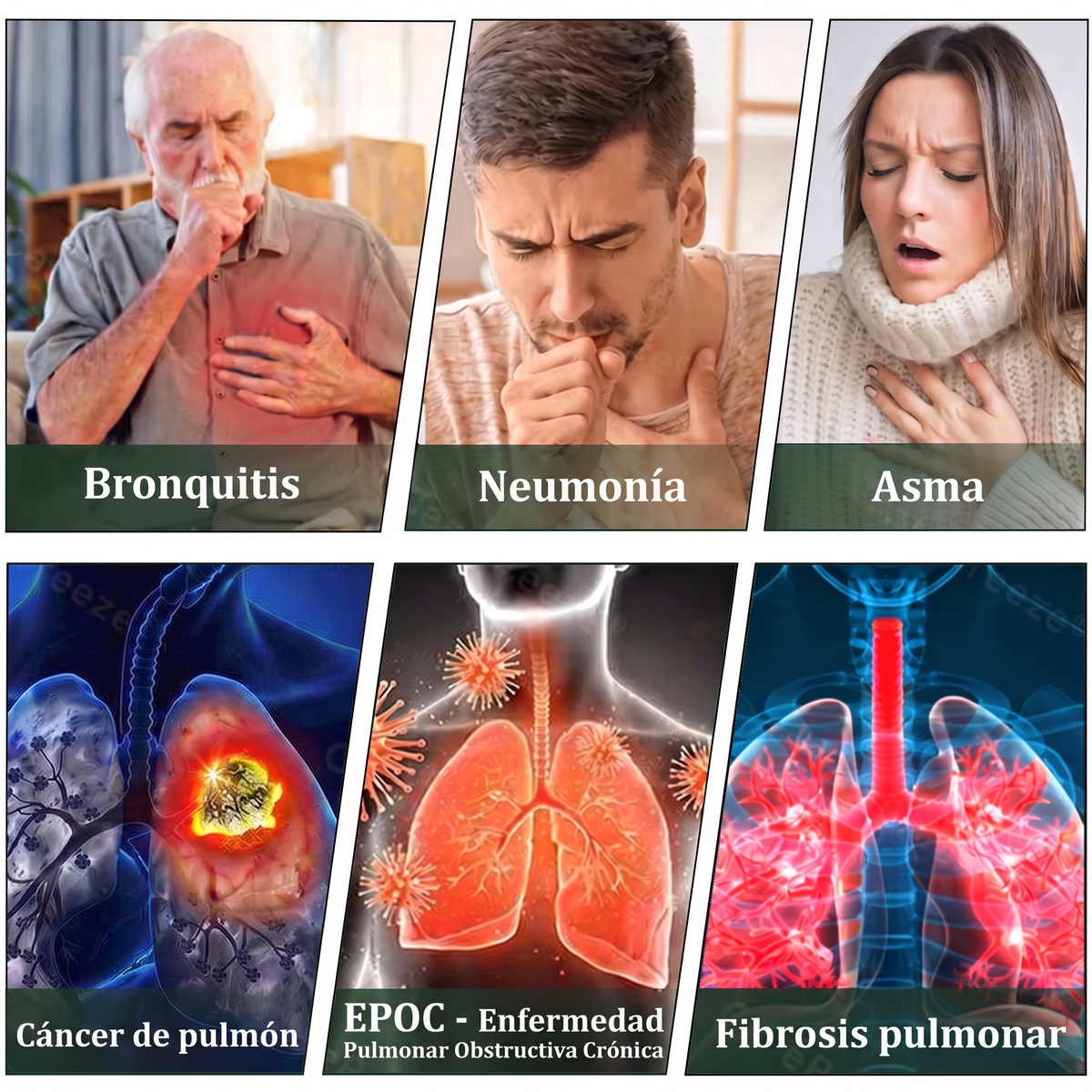 𝐓𝐢𝐞𝐧𝐝𝐚 𝐨𝐟𝐢𝐜𝐢𝐚𝐥 ✅𝐌𝐮𝐫𝑤𝗈𝒏® Difusor Botánico de Mullein para Limpieza de Pulmones (🫁 Tos, faringitis, dificultad para respirar, flema, congestión nasal, bronquitis, síntomas alérgicos, malestar pulmonar)1❤️