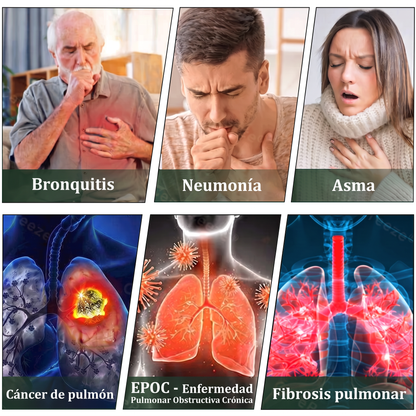 𝐓𝐢𝐞𝐧𝐝𝐚 𝐨𝐟𝐢𝐜𝐢𝐚𝐥 ✅𝐌𝐮𝐫𝑤𝗈𝒏® Difusor Botánico de Mullein para Limpieza de Pulmones (🫁 Tos, faringitis, dificultad para respirar, flema, congestión nasal, bronquitis, síntomas alérgicos, malestar pulmonar)1❤️
